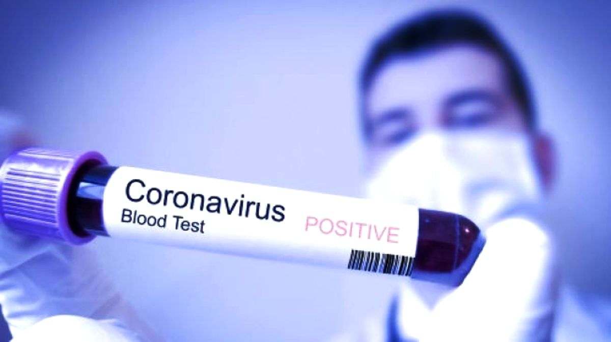 Pelajaran Berharga dari Virus Corona